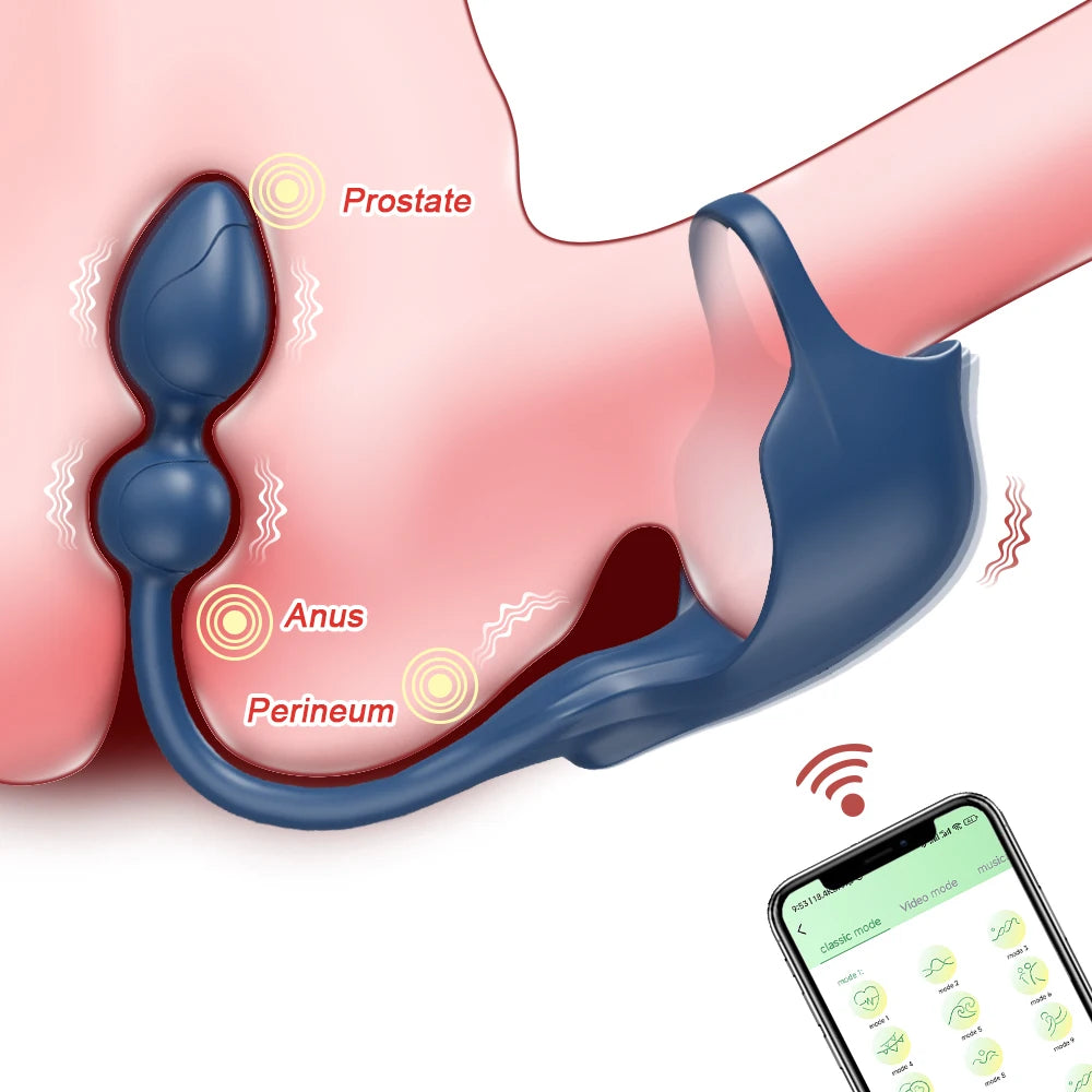 APP Control Vibrating Butt Plug for Men Prostate Massager Anal Vibrator Cock Ring Perineum Scrotum Massager Sex Toy for Couples